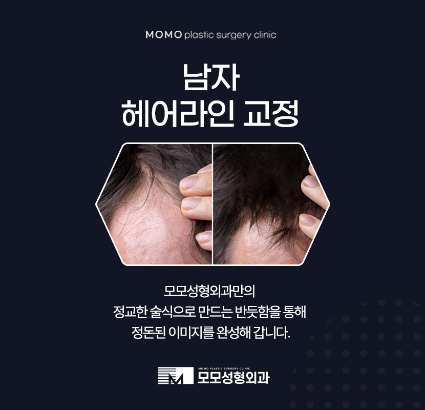 남자헤어라인교정 반듯함으로 완성하는 외모 관련 이미지 1