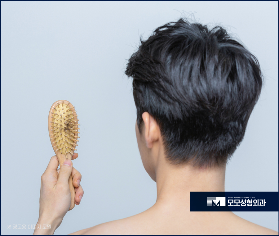 무삭발모발이식 신속한 회복으로 관련 이미지 4