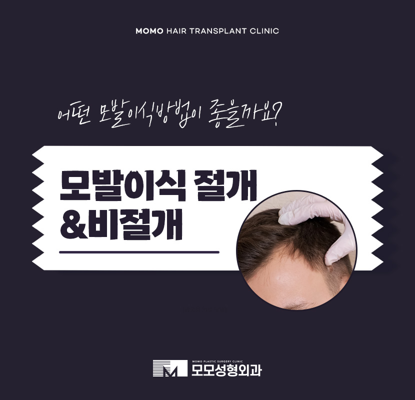 모발이식 절개 비절개 방법을 비교 분석해 가며 관련 이미지 1