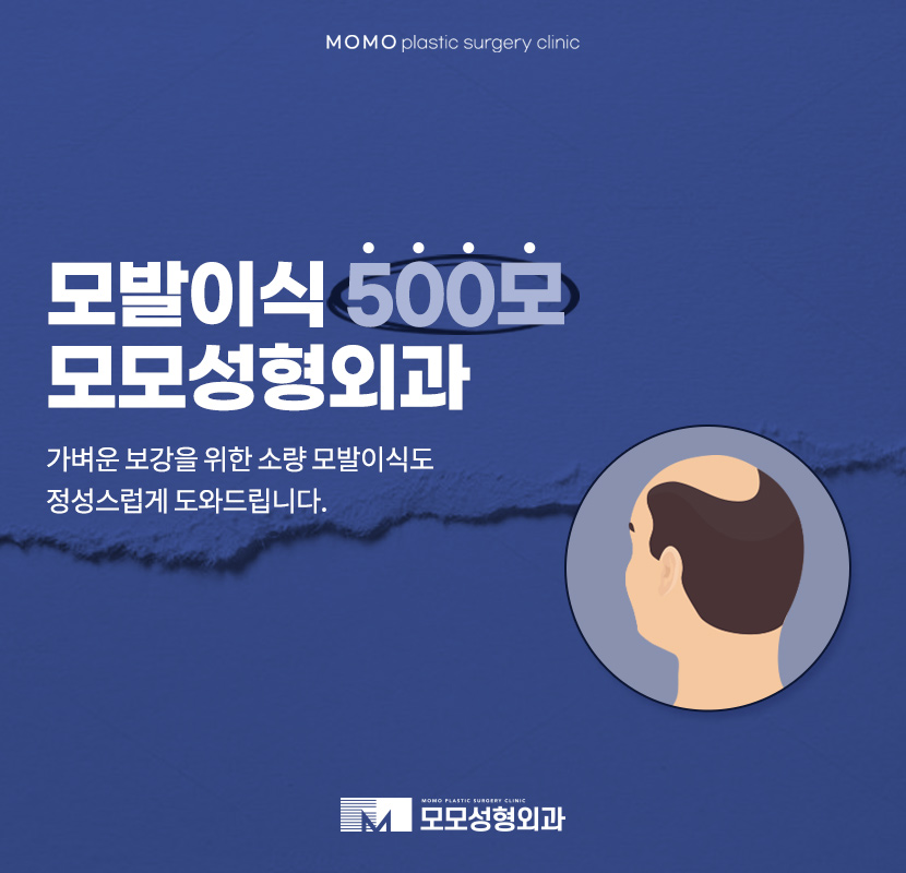 모발이식500모 소량으로 가볍게 보강하기 위한 관련 이미지 1
