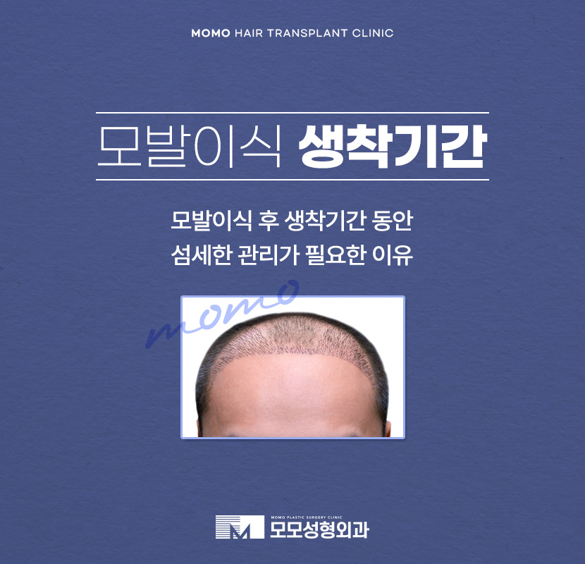 모발이식 생착기간 섬세한 관리가 필요한 이유 관련 이미지 1