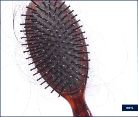 모발이식병원추천 선택 시 꼭 체크할 사항 3가지 관련 이미지 2