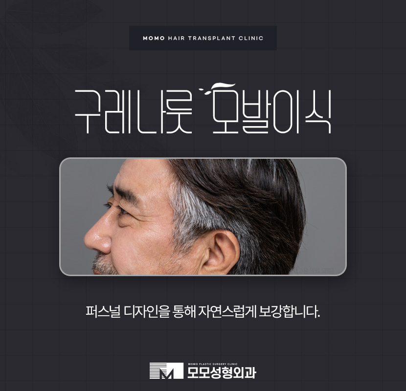 구렛나루 탈모 퍼스널 디자인으로 자연스럽게 관련 이미지 1