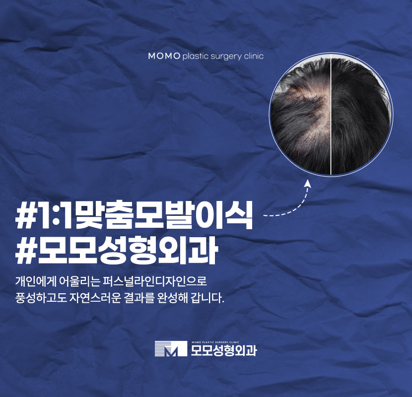 연예인모발이식 성공적인 변화를 위해서 관련 이미지 1