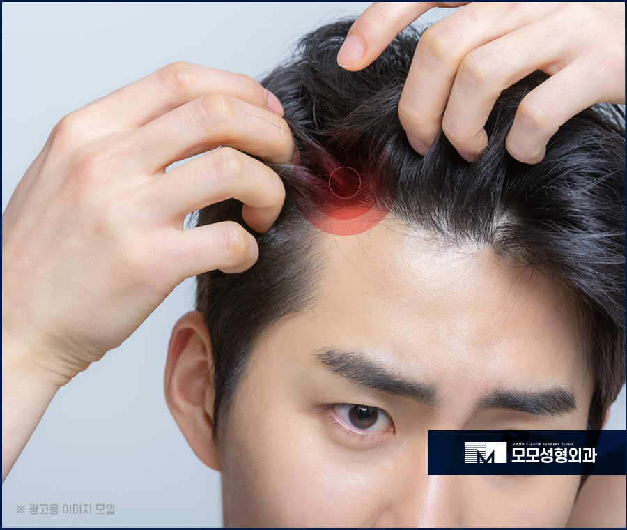 두피모낭염 증세와 해결 방법에 대해 관련 이미지 5