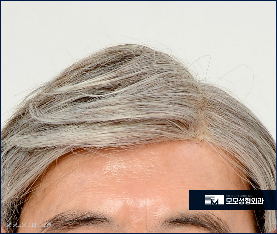 흰머리나는시기와 예방하는 방안 관련 이미지 2