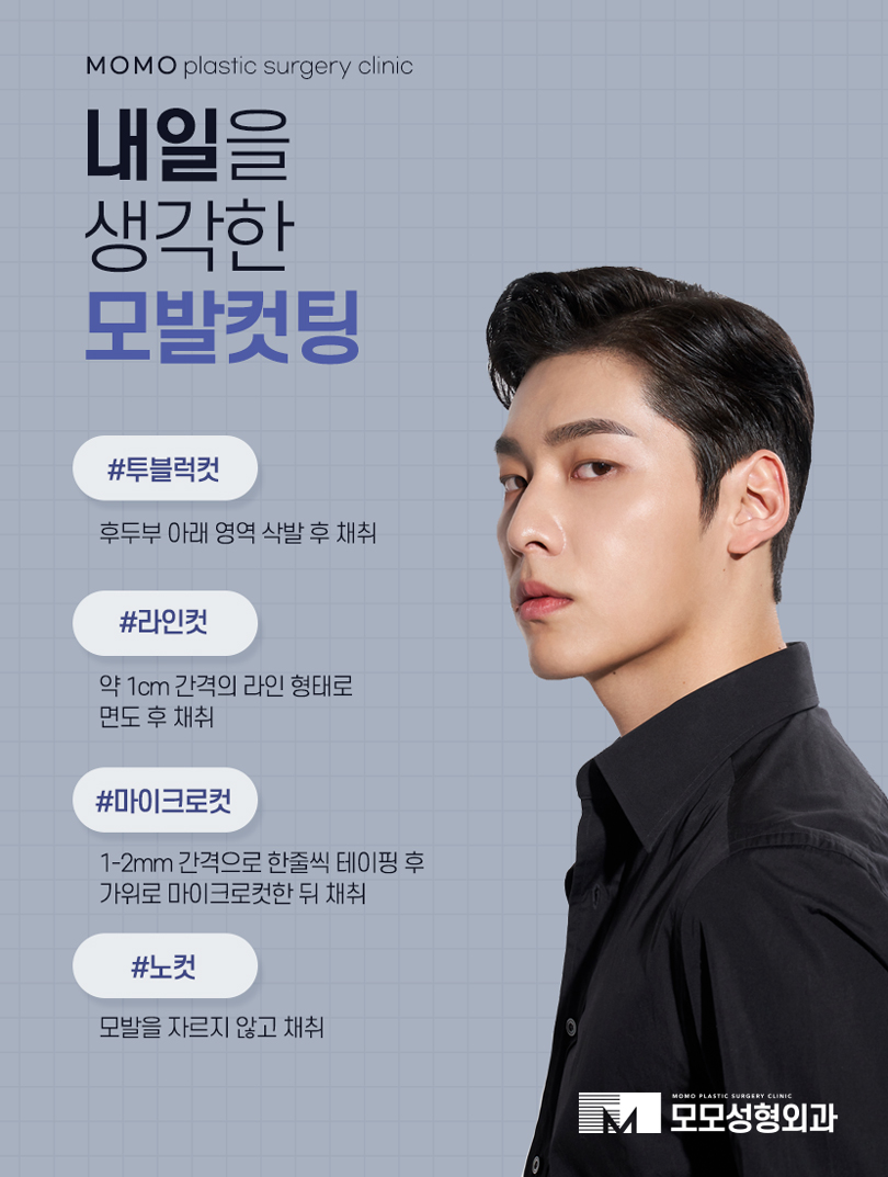 모발이식5000모 얼굴형까지 적절히 유념해서 관련 이미지 10