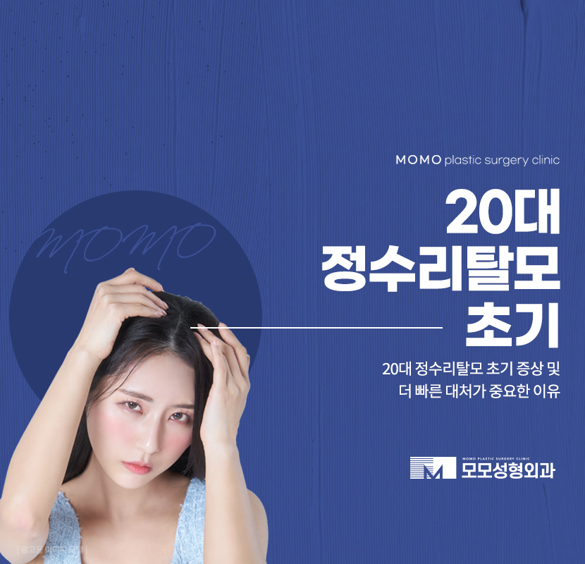 20대정수리탈모초기 신속한 대응이 중요합니다 관련 이미지 1