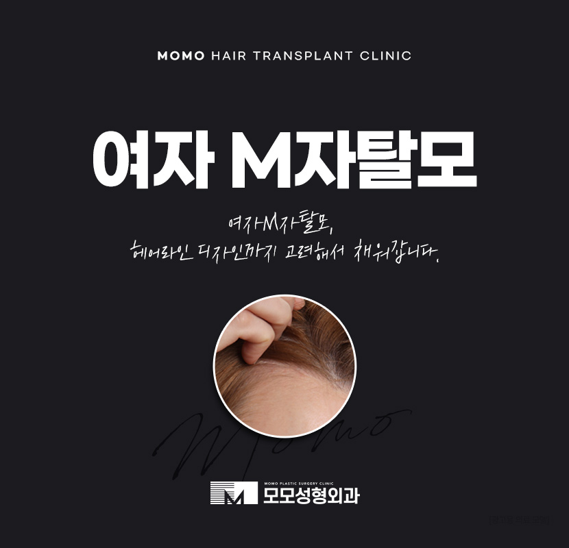 여자m자탈모 헤어라인 디자인까지 고려해 채우는 관련 이미지 1