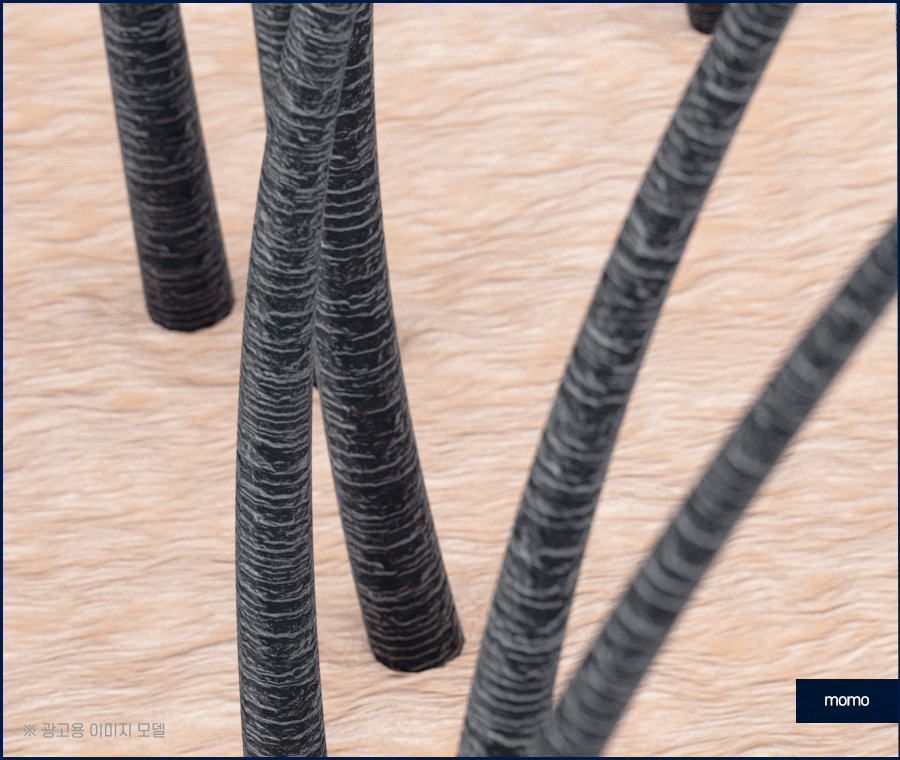 모발이식 생착률 기준짓는 요소들은 무엇일까 관련 이미지 5