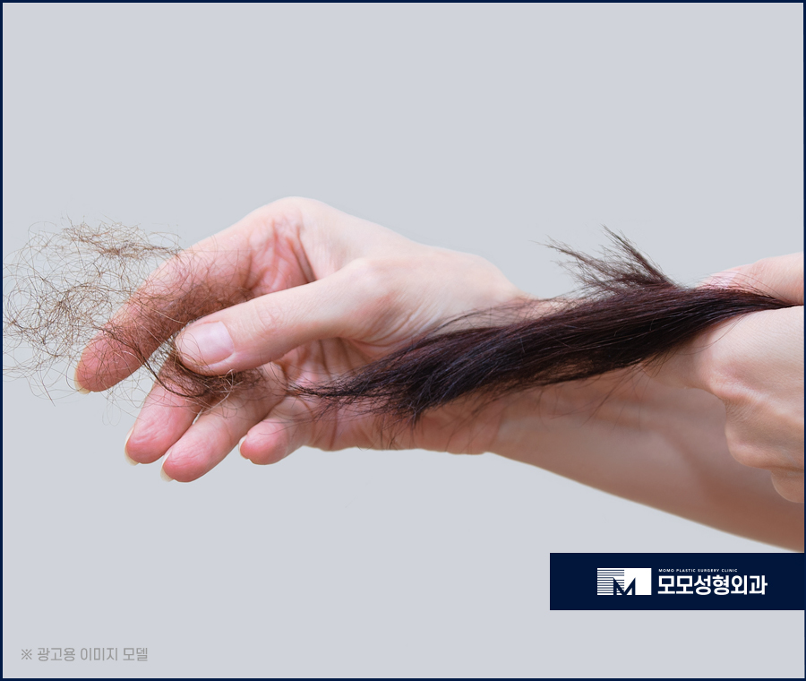 출산후머리빠짐 자연스러운 해결 방안에 대하여 관련 이미지 3