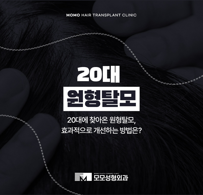 20대 원형탈모 효과적인 개선 방법은 관련 이미지 1