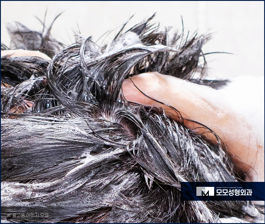 모발이식 암흑기를 이겨내기 위해 알아야 할 점 관련 이미지 3