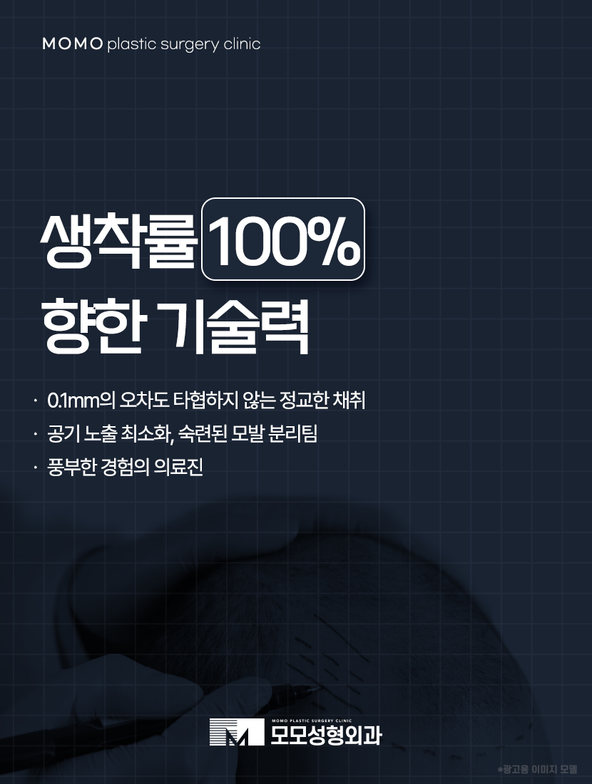 모발이식 3000모 어떤 분들에게 적절할까요 관련 이미지 12