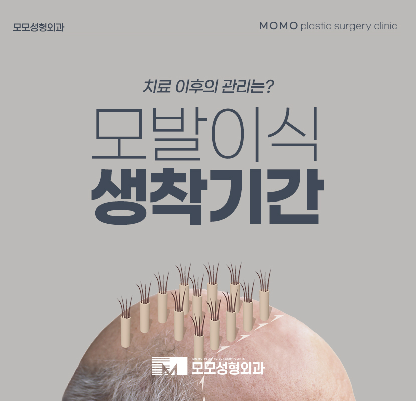 모발이식생착기간 좌우하는 기준은 무엇인지 관련 이미지 1