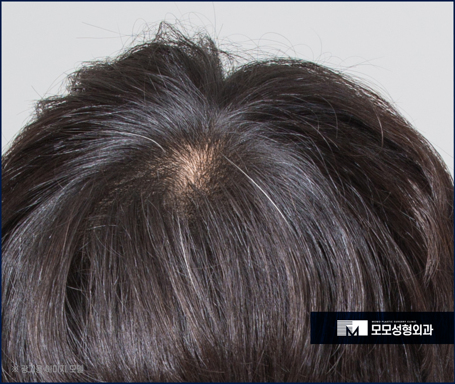 새치염색주기 무리를 주지 않는 선은 관련 이미지 10