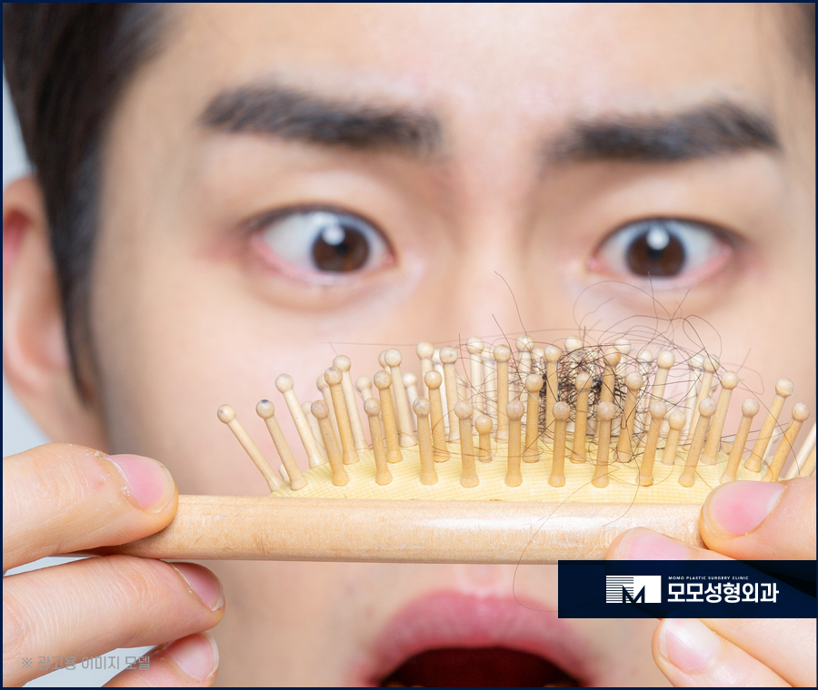 마이크로컷 비절개 모발이식 자연스러운 이후 외모를 관련 이미지 2