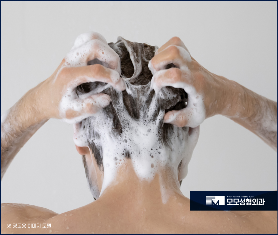 모발이식2주가 되면 어떤 변화가 찾아올까요 관련 이미지 7