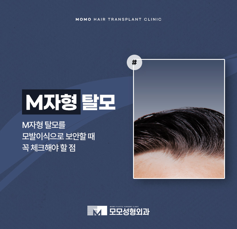 m자형 탈모 보완 시 꼭 짚어야 할 체크 포인트 (ft. 모발이식) 관련 이미지 1
