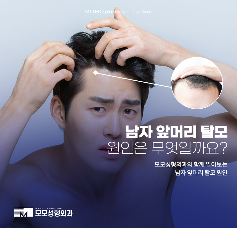 남자앞머리탈모원인과 극복하기 위한 방안에 대해 관련 이미지 1