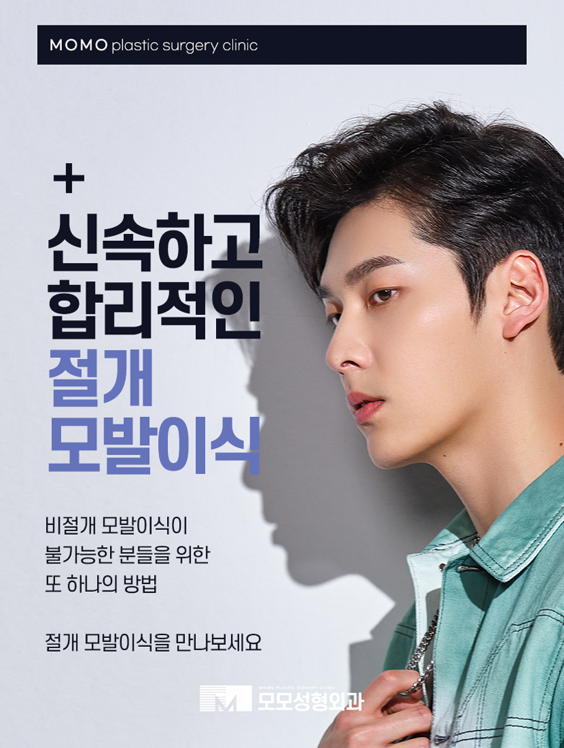 머리심기비용 방식에 따라 나뉘어지는 관련 이미지 5