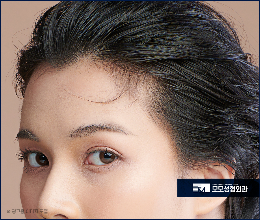 여자M자탈모치료 고민되는 상황에서는 관련 이미지 3