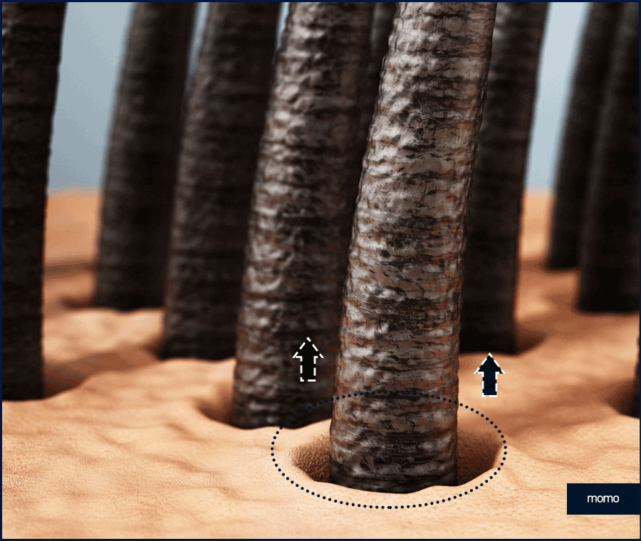 20대 탈모약 처방 및 복용 시 꼭 확인해야 할 점 관련 이미지 7