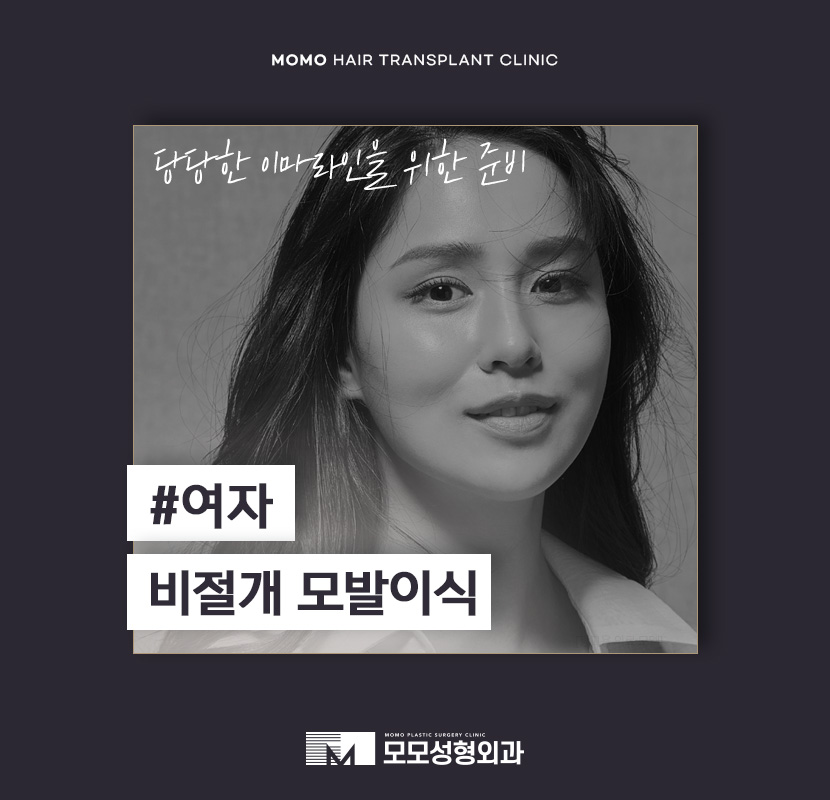 여자비절개모발이식 당당한 이마 라인을 뽐내도록 관련 이미지 1