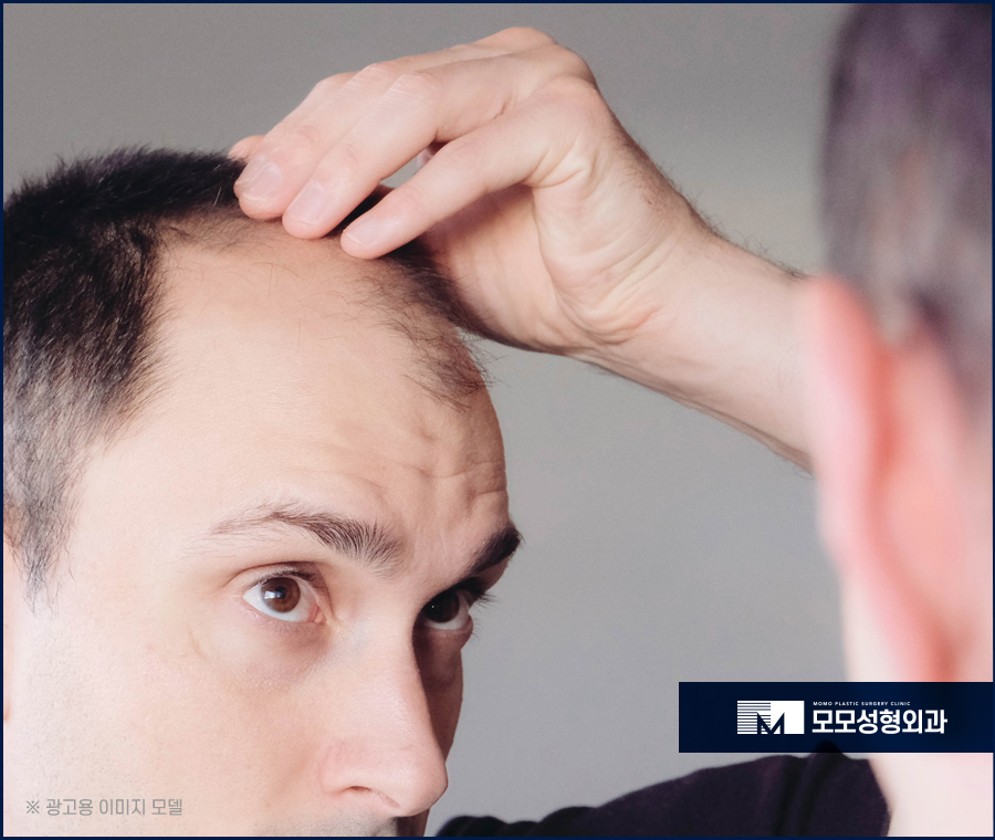모발이식회복기간 신속하게 이뤄지는 방향은 관련 이미지 2