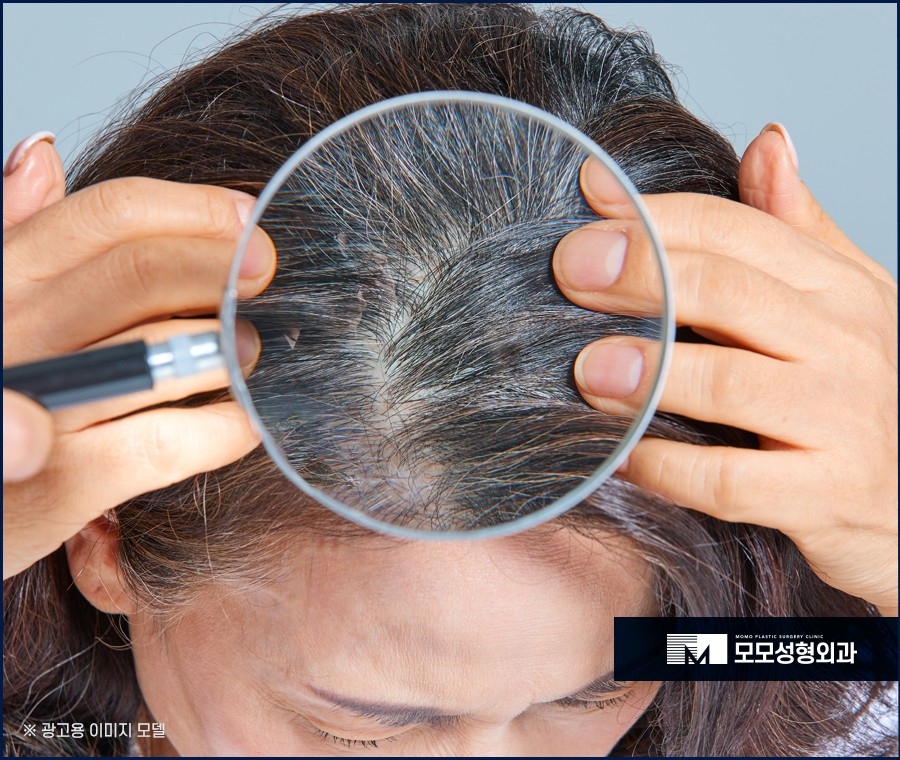 새치나는이유와 처리 방법에 대해 관련 이미지 5