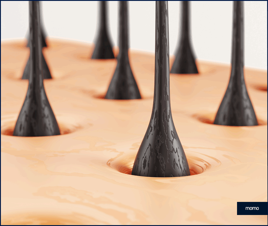 여자 정수리 탈모 초기 증상 및 머리카락빠짐 대응 방안 관련 이미지 8