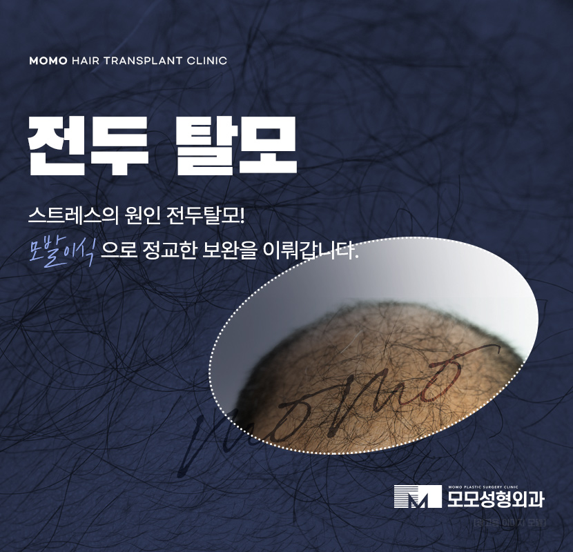 전두탈모 원인 보강을 위한 현명한 선택은? 관련 이미지 1