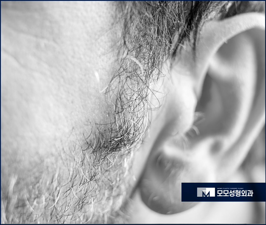 구렛나루 탈모 퍼스널 디자인으로 자연스럽게 관련 이미지 5