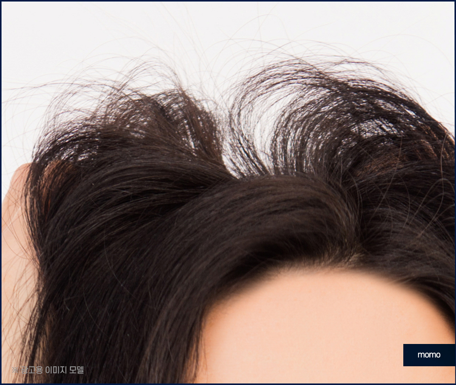 돼지털 머리카락 원인 및 완화하는 방법 3가지 관련 이미지 4