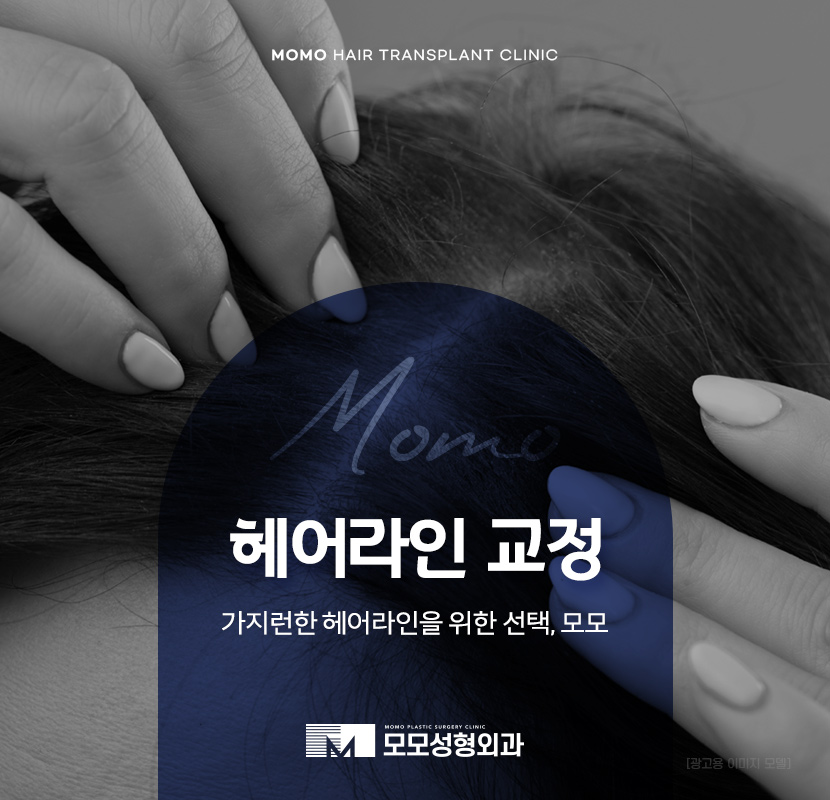 헤어라인 교정 비용 및 방법 디자인의 중요성 관련 이미지 1