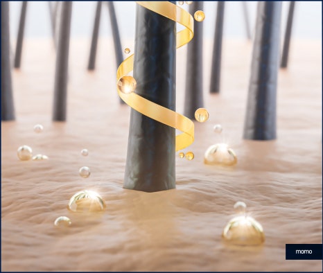 압구정역 모발이식 방법 및 생착률을 높이는 팁 관련 이미지 7