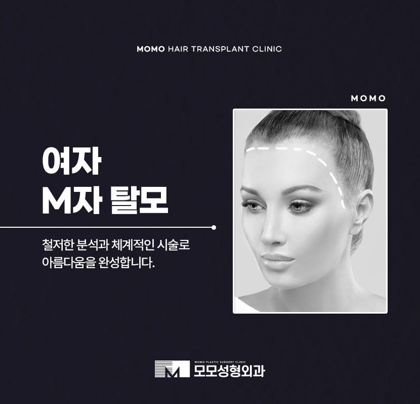 여자 M자 탈모 자연스럽게 채워가는 관련 이미지 1
