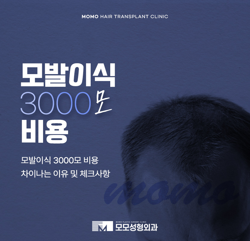 모발이식 3000모 비용 차이나는 이유 및 방법 관련 이미지 1