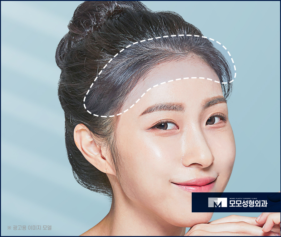 여자이마탈모 유발하는 원인과 개선 방법까지 관련 이미지 2