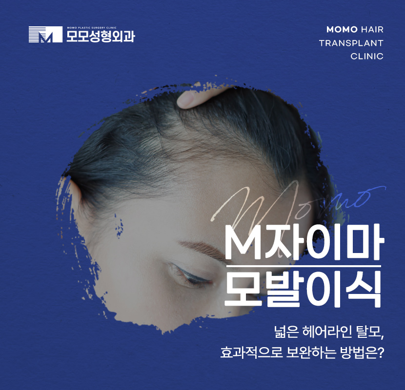 엠자이마 탈모 헤어라인 모발이식으로 관리하기 관련 이미지 1