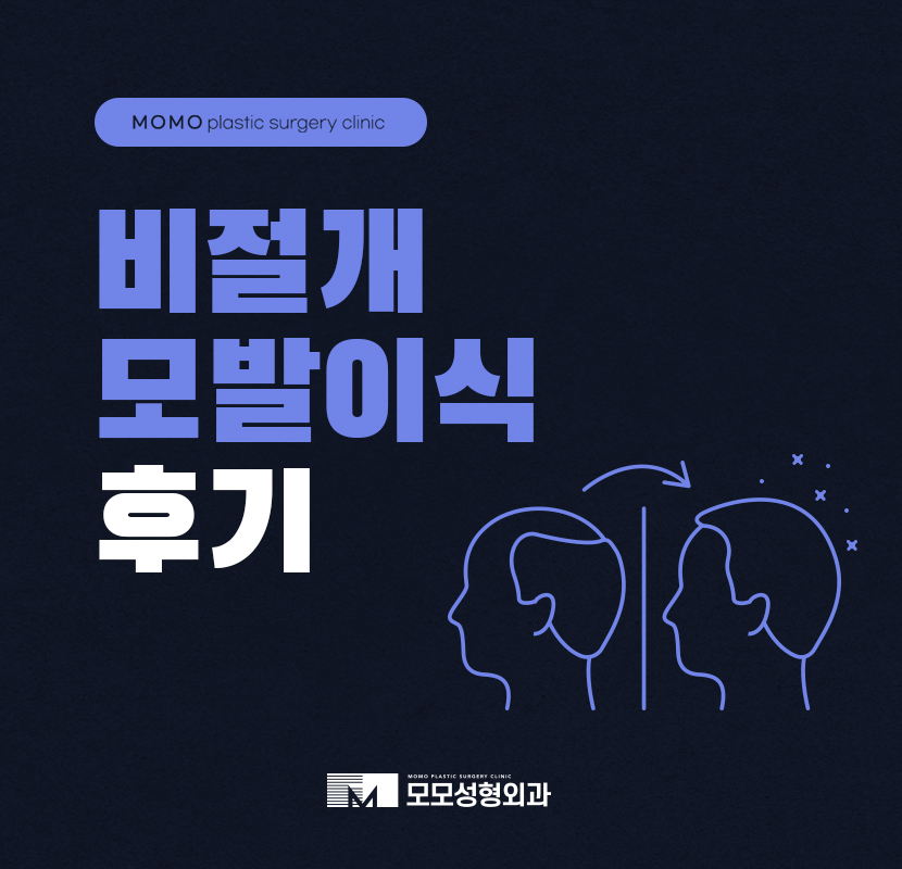 비절개모발이식후기 선택을 하기 위해 관련 이미지 1