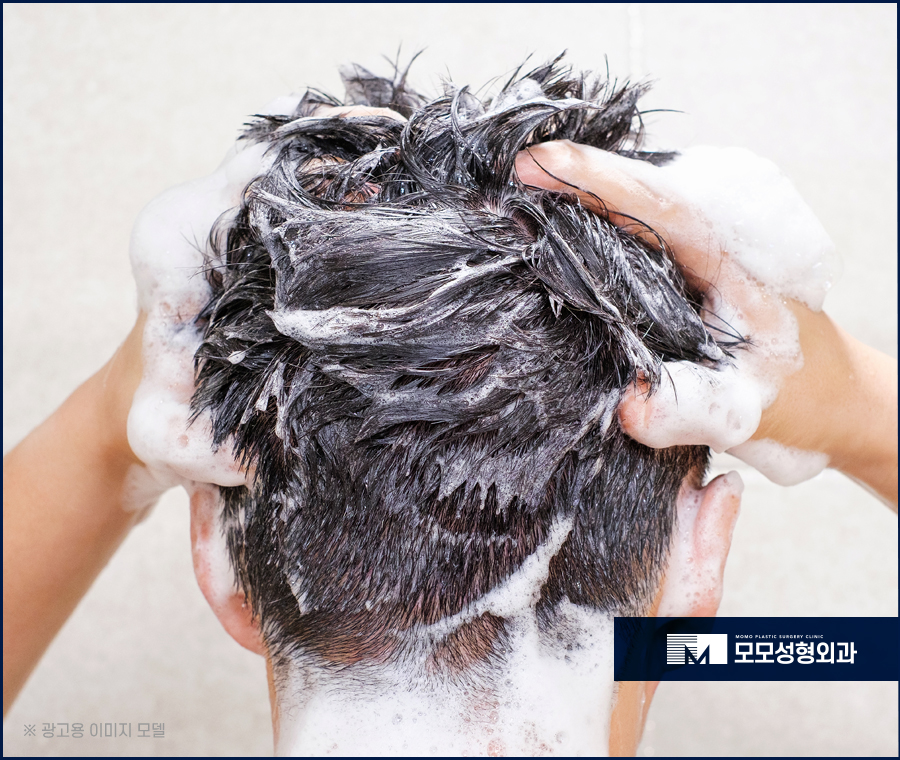 모발이식 후 흡연 기준과 주의해야 할 점에 대하여 관련 이미지 4