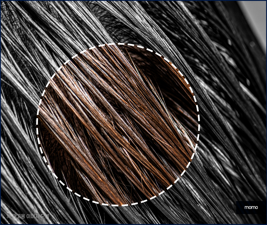 정수리 냄새 제거 원인부터 탁월한 제거 방안까지 관련 이미지 9