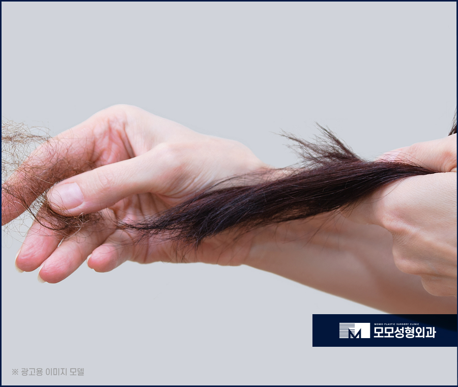 남자엠자탈모 극복을 위한 방향을 잘 잡아야만 관련 이미지 8