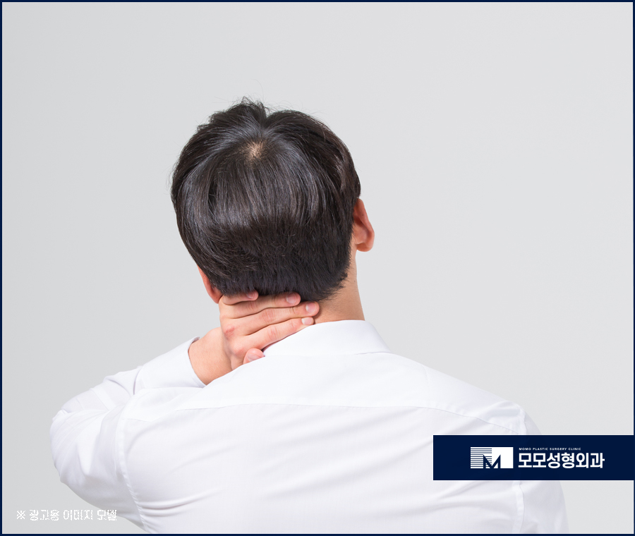 지루성두피염증상 어떤 것들이 있는지 관련 이미지 5