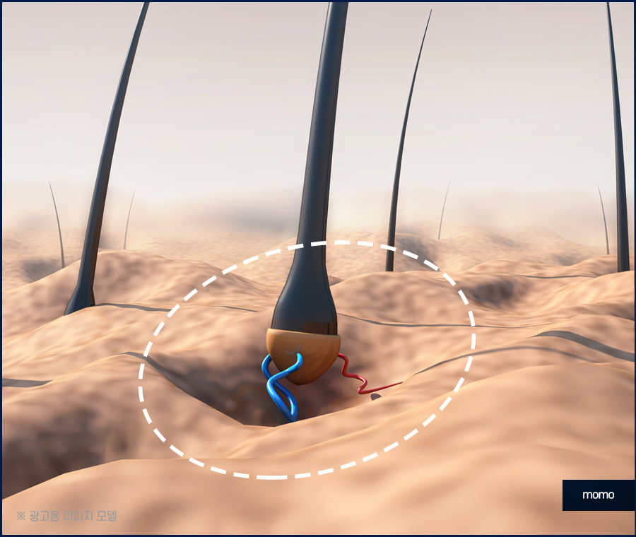 모발이식재수술 원인 파악을 먼저 관련 이미지 6