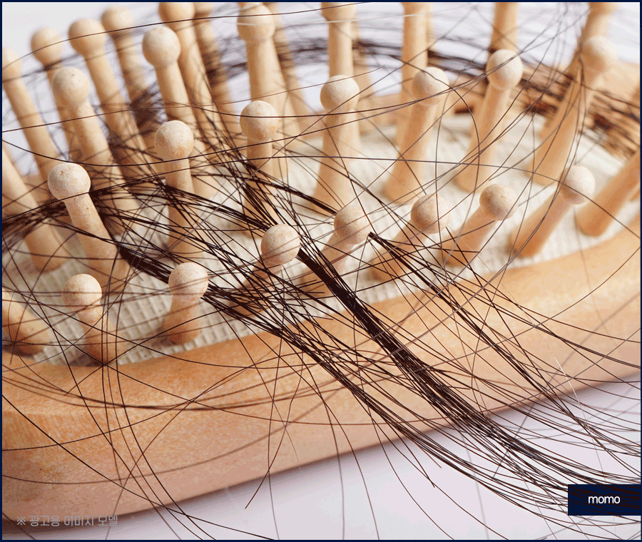 압구정 모발이식 병원 찾고 있다면 꼭 확인하세요 관련 이미지 3