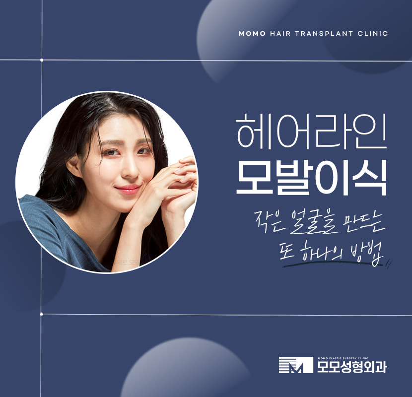 여자헤어라인모발이식 이마 높이 변화로 작은 얼굴 효과 관련 이미지 1