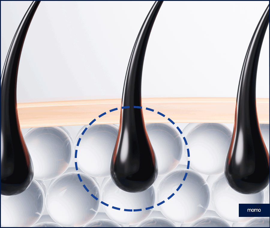 남자 탈모약으로 치료할 때 확인할 사항 관련 이미지 6