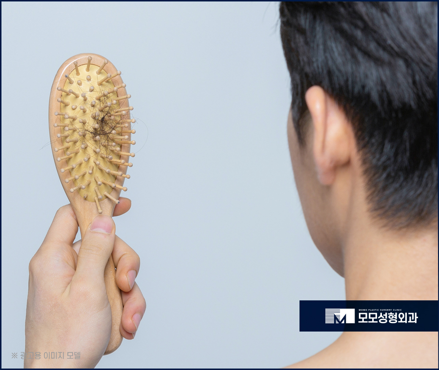 스트레스성탈모 나타나게 된 원인은 관련 이미지 3